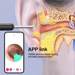 Smart Visual Ear Cleaner (HD Camera)