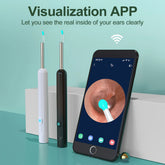 Smart Visual Ear Cleaner (HD Camera)