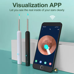 Smart Visual Ear Cleaner (HD Camera)