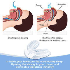 Adjustable Anti-Snore Mouth Guard