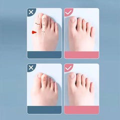 Silicone Toe Separator Set